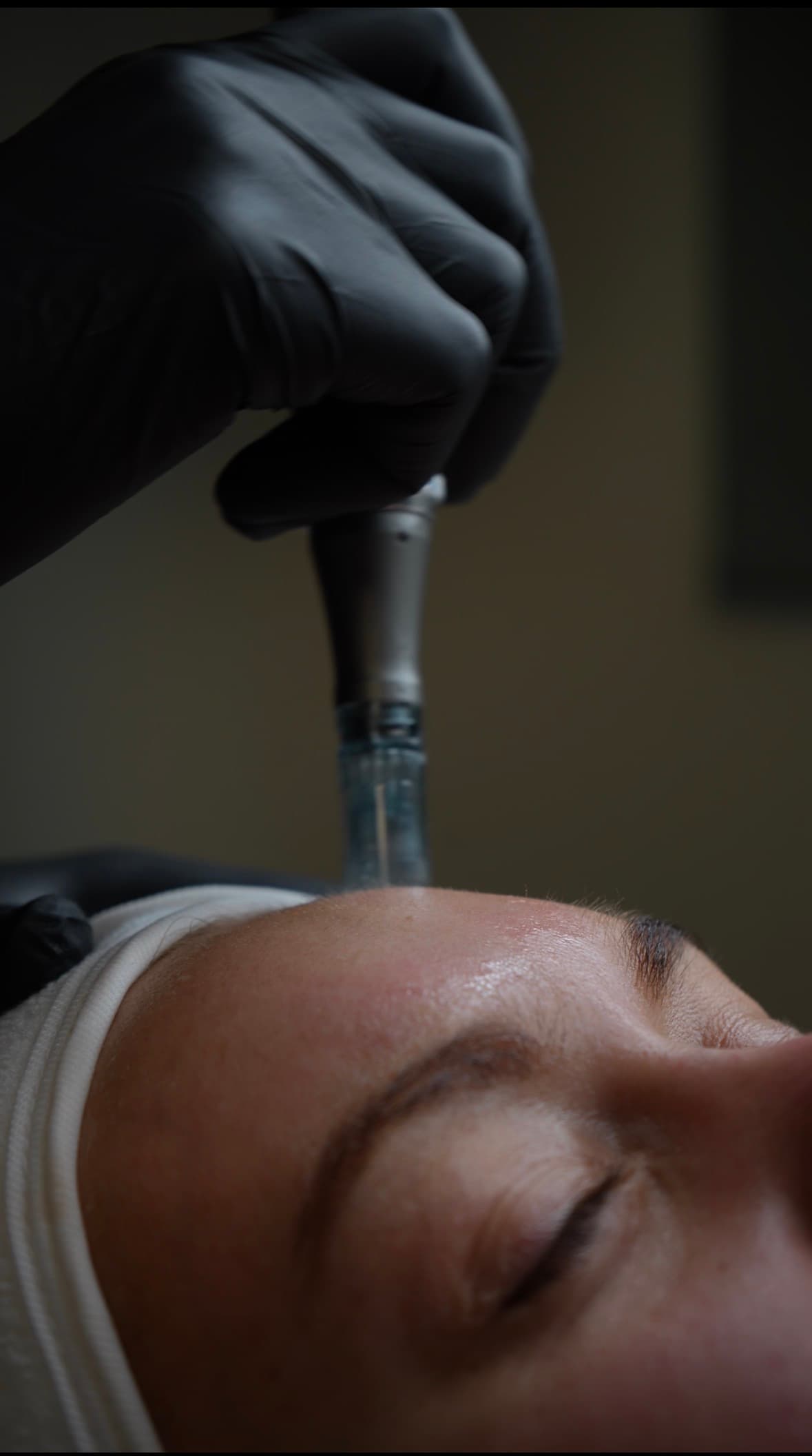 Skin treatment at Darling Medical Aesthetics